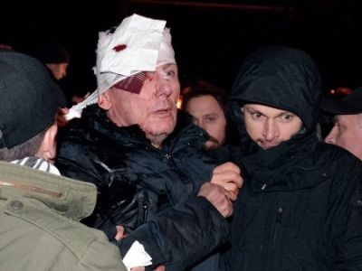 Избитый Юрий Луценко. Фото: REUTERS/Stringer Избитый Юрий Луценко. Фото: REUTERS/Stringer
