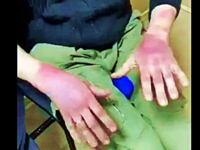 После пыток в полиции. Фото: Александр Воронин, Каспаров.Ru После пыток в полиции. Фото: Александр Воронин, Каспаров.Ru